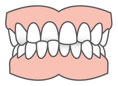 Common Orthodontic Problems