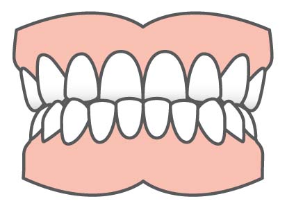 Common Orthodontic Problems